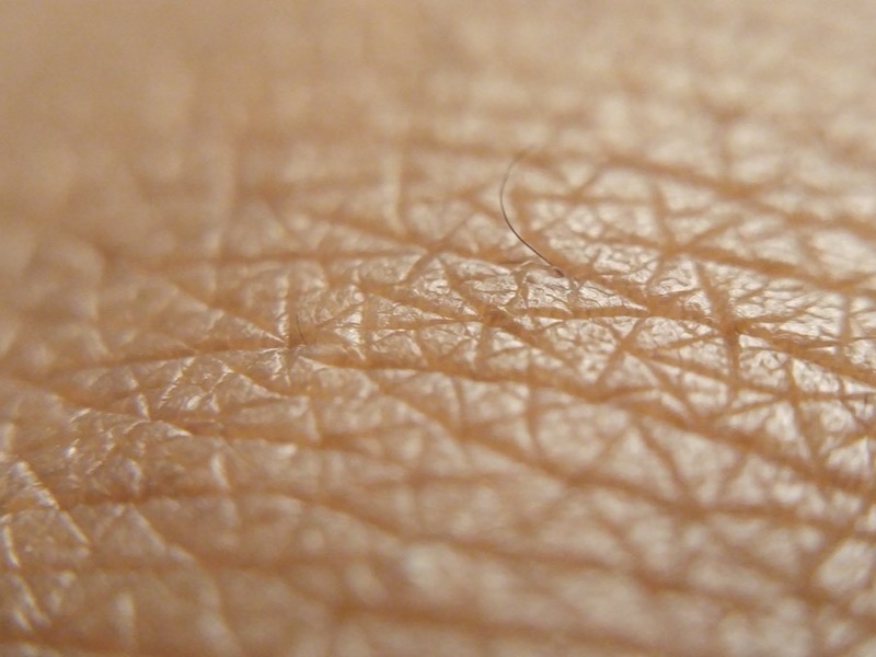 Dermatologie